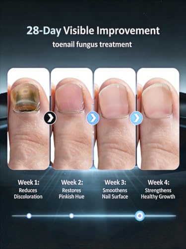 2026 Upgrade Toenail Fungus Treatment【Maximum Undecylenic Acid & Tea Tree】 - color: White-3 Pack