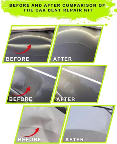 25pcs Dent Puller Kit,Paintless Dent Repair Kit for Dent Removal - color: 25pcs