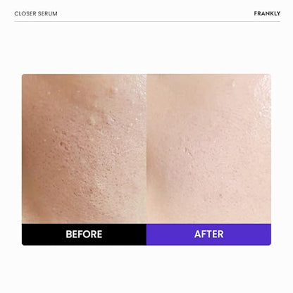 FRANKLY Closer Serum | Pore Minimizer Serum | 9 Peptides, Vegan Collagen, Adenosine, PHA | Korean Pore Minimizer for Glass Skin, Anti-Aging, Hydration, Elasticity | 1.01 fl oz (Pack of 2) - size: 1.01 Fl Oz (Pack of 2)
