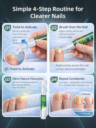 2026 Upgrade Toenail Fungus Treatment【Maximum Undecylenic Acid & Tea Tree】 - color: White-3 Pack
