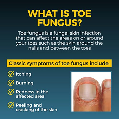 Fungi-Nail Pen Applicator Anti-Fungal Solution 0.101 Fl Oz, 2 Pack - size: 0.1 Fl Oz (Pack of 2)