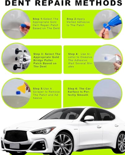 25pcs Dent Puller Kit,Paintless Dent Repair Kit for Dent Removal - color: 25pcs